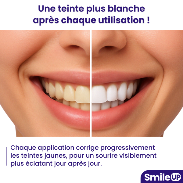 SmileUP